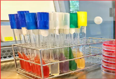 Solidified and broth Agar Media in test tubes